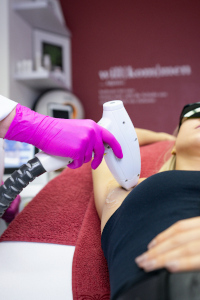 Dauerhafte Haarentfernung bei einer jungen Frau an den Achseln mit einem Laser